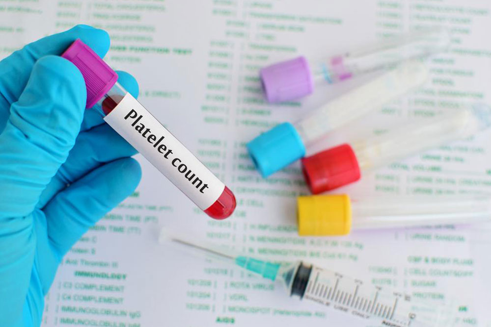 Low platelets count – Its causes and symptoms